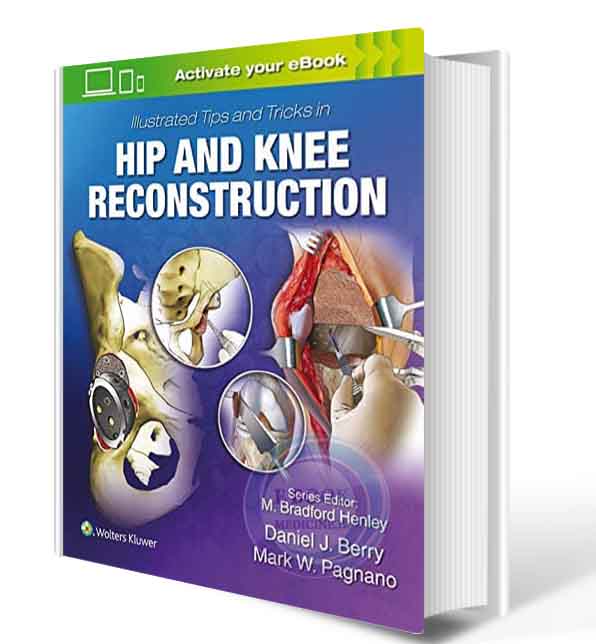 دانلود کتابIllustrated Tips and Tricks in Hip and Knee Reconstructive and Replacement Surgery 1st 2020 (PDF)